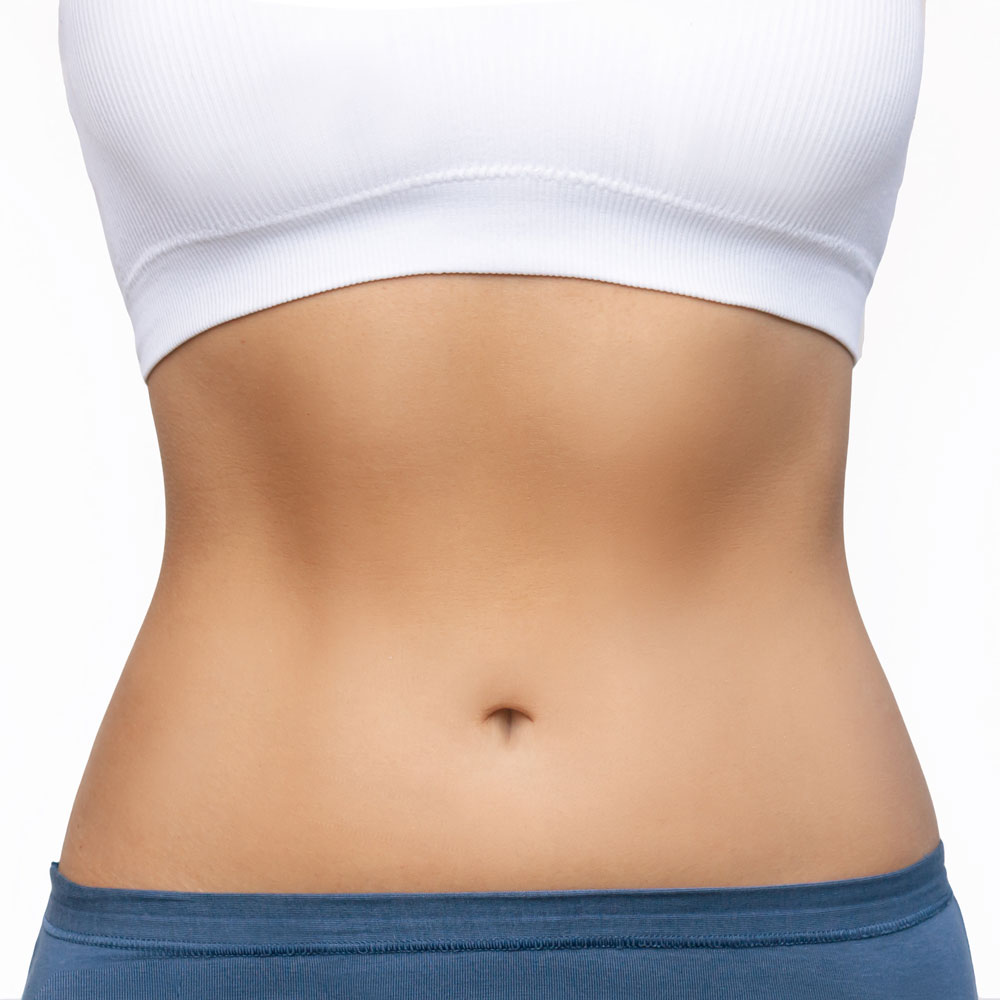 Tummy tuck - Prof. Dr Charlotte Holm Mühlbauer is a specialist in plastic and aesthetic surgery
